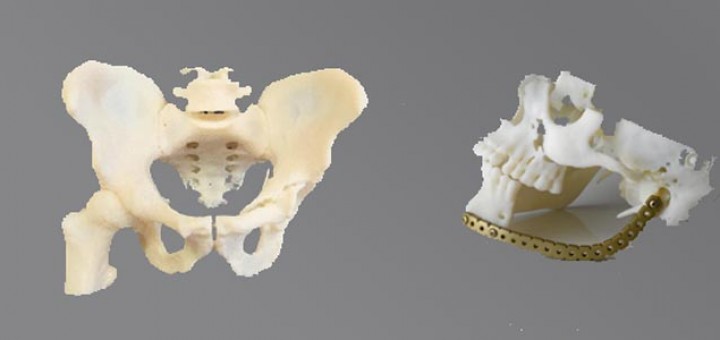 3D printer_bone implant_banner