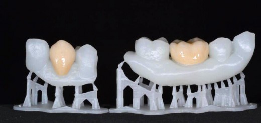 Douw_Formlabs_3_Glazed_crowns