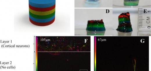 bioprinted brain mold