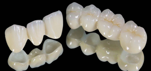 cremic-dental-crown