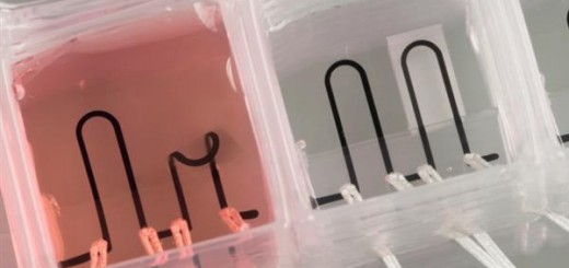 organ-on-chip