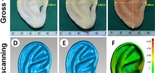 China 3d printing ear 2