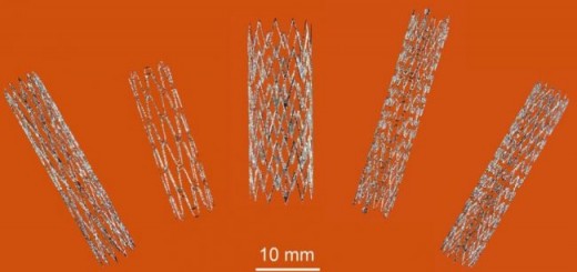 Part_self-expanding-nitinol-stents_SLM_CSIRO