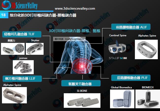 Whitepaper_Orthopedic Implant_18