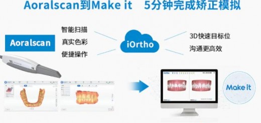 shining3D-Dental_2