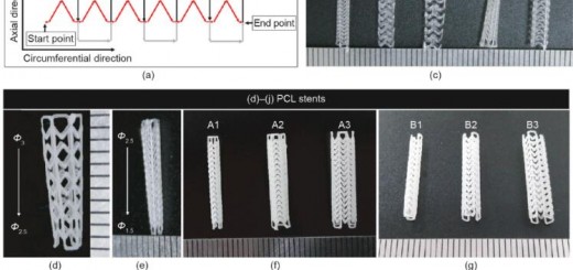 Article_stents_18